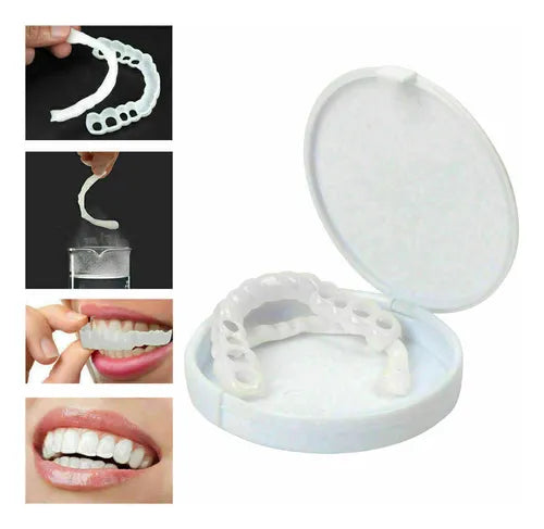 Carillas Dentales Snapon Smile